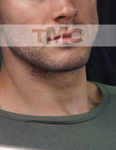 gigolo voor een stel in Amsterdam